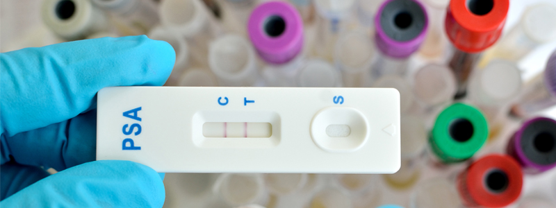 PSA screening test